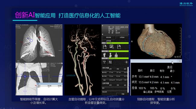医学影像AI换代级产品 推动二维影像向“三维+人工智能”升级