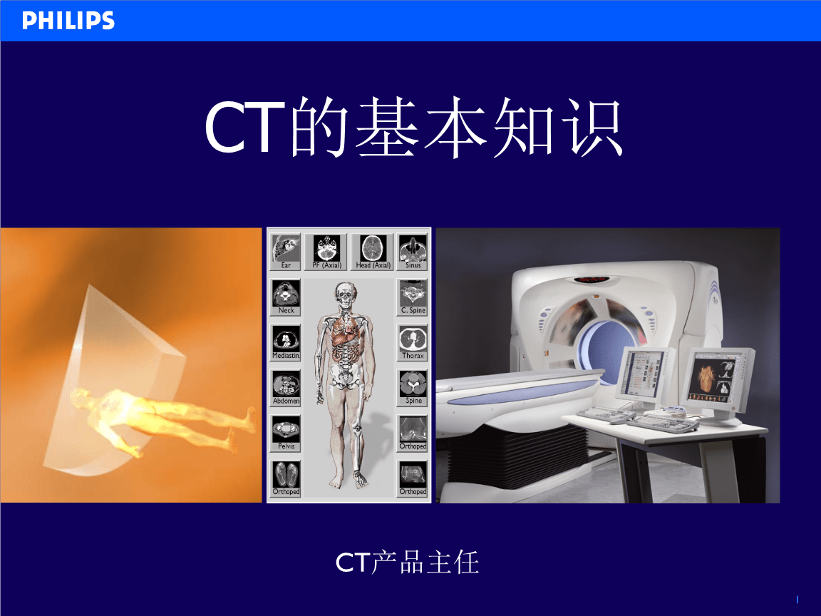 CT的基本知识 医学影像的核心技术