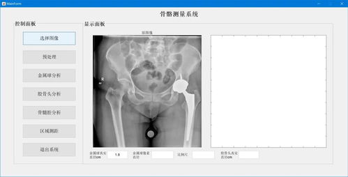 技术赋能医学 基于MATLAB的骨骼测量系统构建医学影像诊断新范式