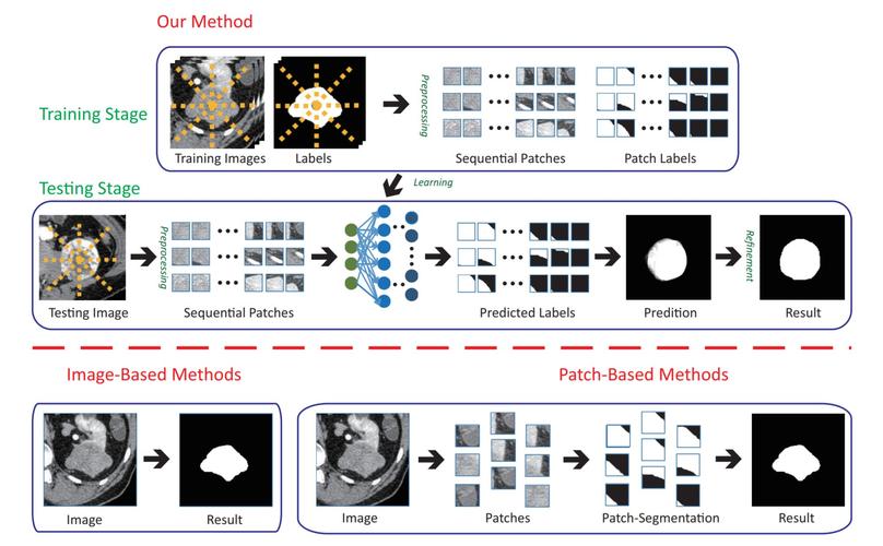 medical image segmentation